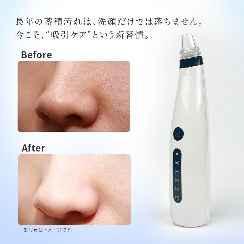 毛穴吸引器